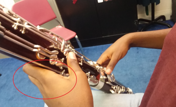 collapsed left hand that needs a handrest