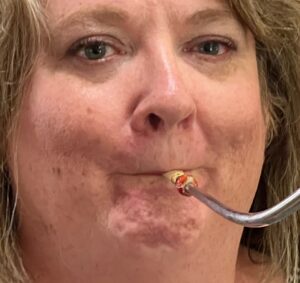 embouchure that is too tight